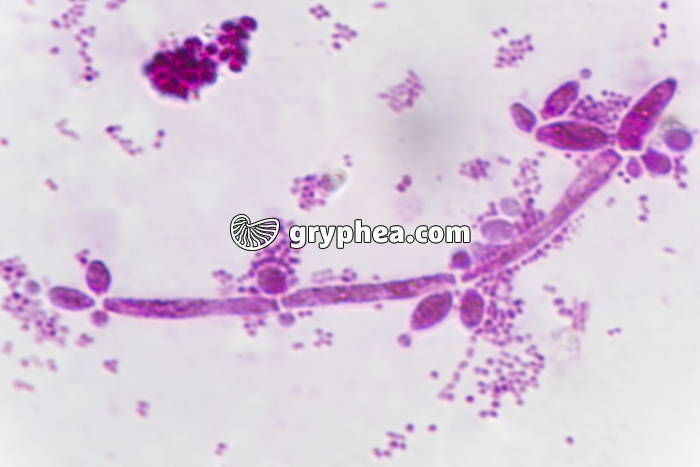 Staphylocoques et Candida albicans x800 - gryphea.org